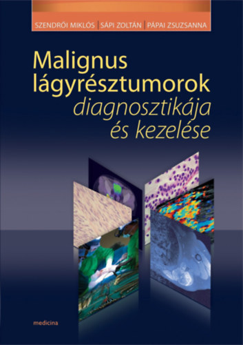 Szendr�i Mikl�s, S�pi Zolt�n, P�pai Zsuzsa (szerkeszt�k) - Malignus l�gyr�sztumorok diagnosztik�ja �s kezel�se