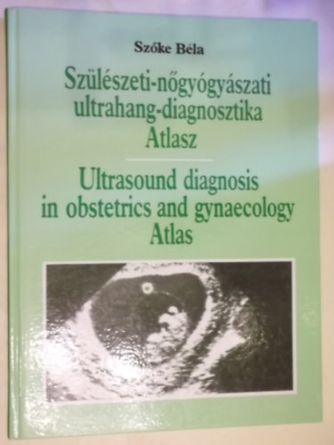 Sz�l�szeti-n�gy�gy�szati ultrahang-diagnosztika Atlasz