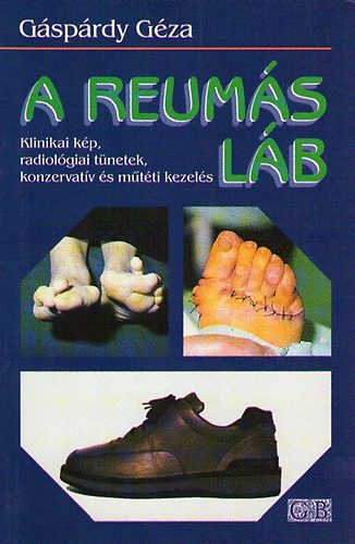gáspárdy géza - A reumás láb