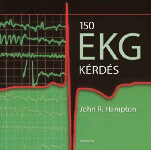 John R. (szerk.) Hampton - 150 EKG k�rd�s