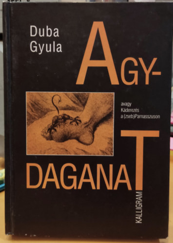 Duba Gyula - Agydaganat