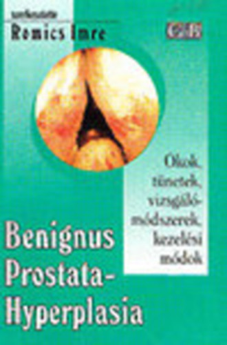 Romics Imre (szerk.) - Benignus prostatahyperplasia