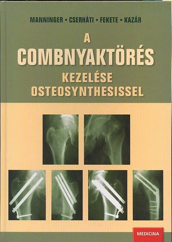 Cserh�ti P�ter, Hanninger Jen�, Dr. Fekete K�roly - A combnyakt�r�s kezel�se osteosynthesissel
