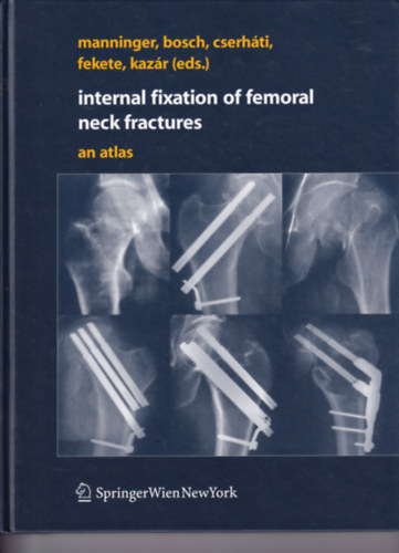 Jen Manninger, Pter Cserhti, Kroly Fekete, Gyrgy Kazr - Internal Fixation of Femoral Neck Fractures