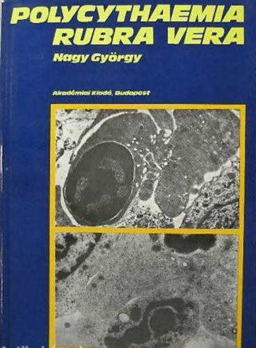 Dr. Nagy Gy�rgy - Polycythaemia Rubra Vera klinikuma, pathologi�ja �s korszer� kezel�se