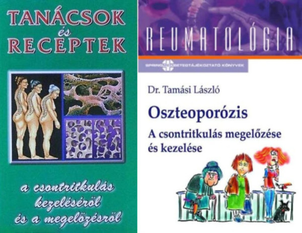 Dr. Tamsi Lszl, Dr. Vrtes Pter - 2 db m a csontritkuls kezelsrl: Oszteoporzis - A csontritkuls megelzse s kezelse + Tancsok s receptek a csontritkuls kezelsrl s a megelzsrl